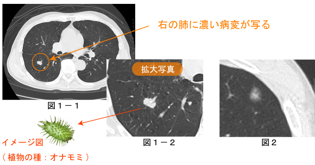 chestCT 1.jpg