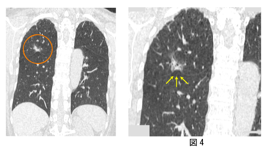 chest CT2.jpg