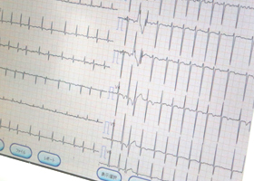 ECG-2.jpg