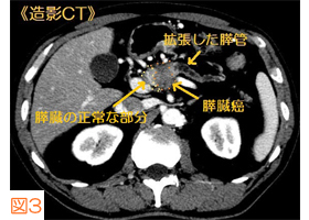 eCT1-2.jpg